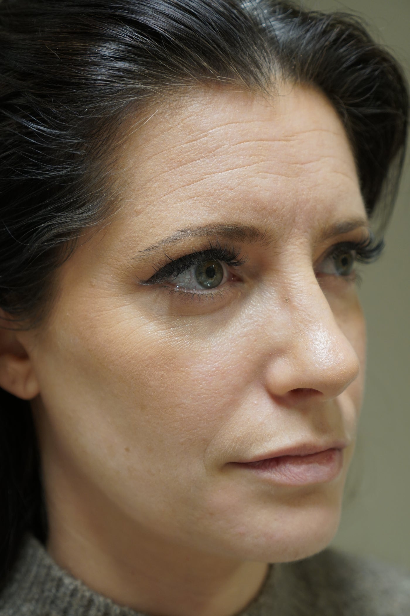 DOC BERGER EFFECT Hyper Hyaluron Serum: Before and After Results