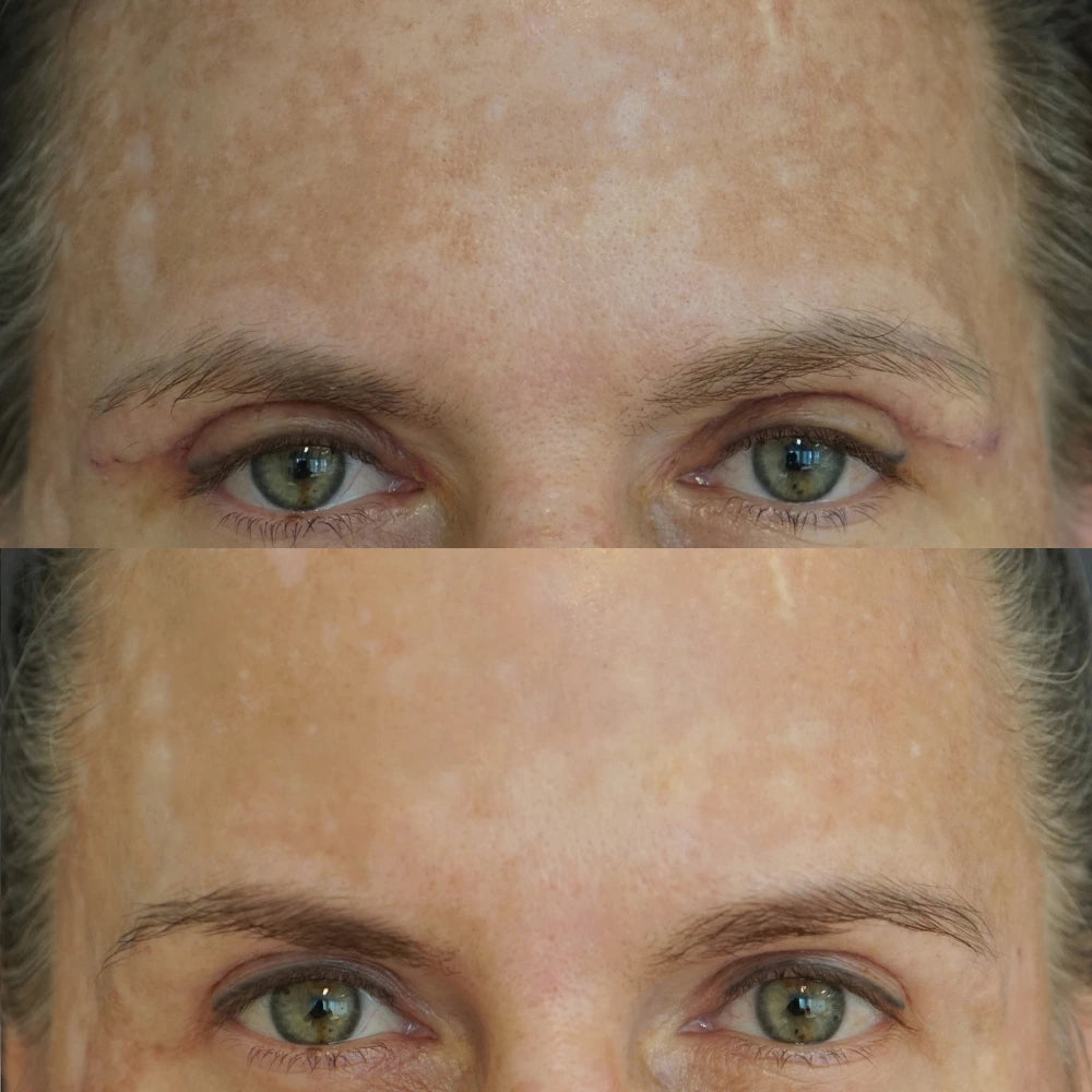 Ruth vorher nachher vergleich mit retinol von doc berger effect