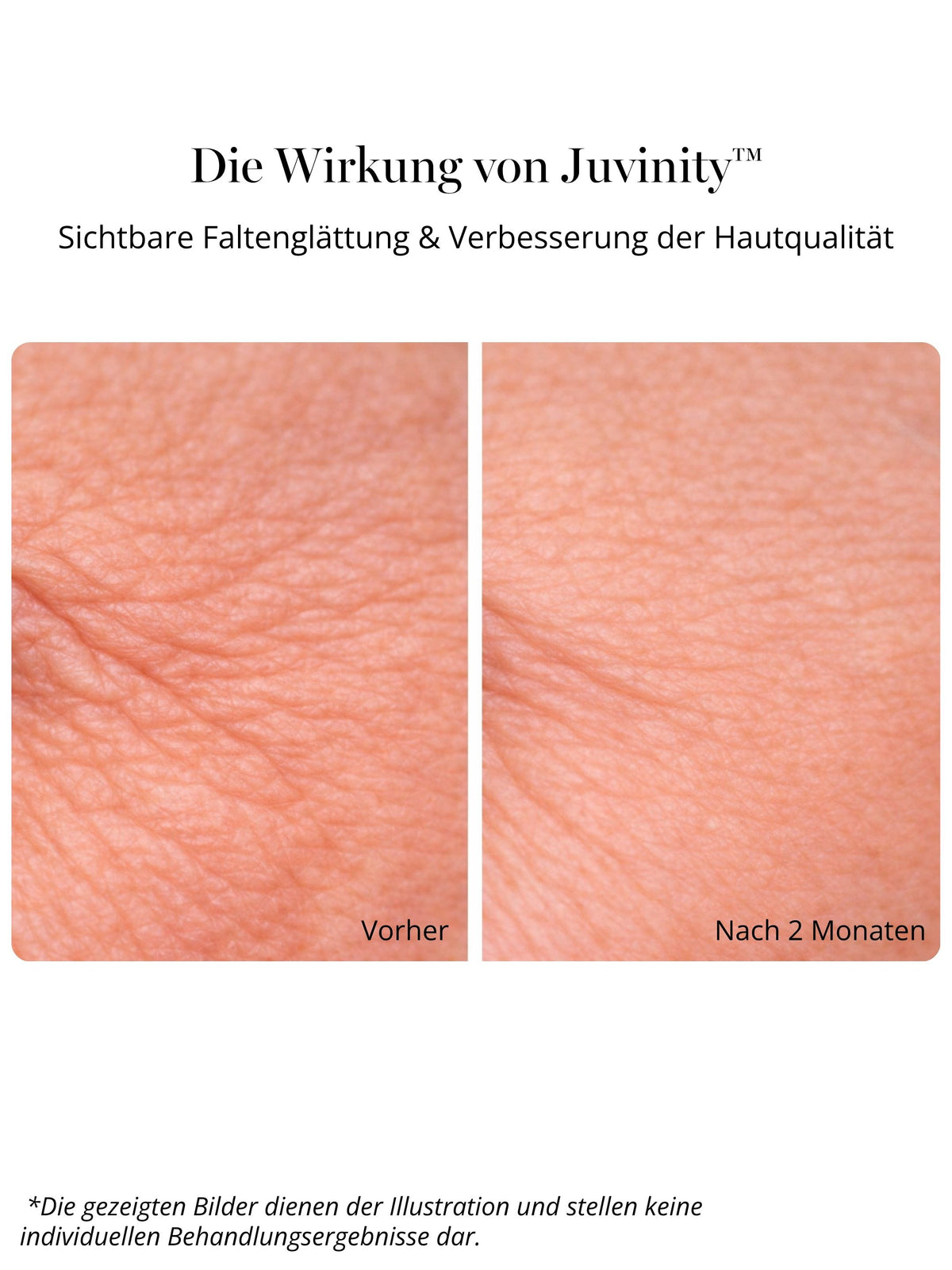 Anti-Aging Nachtcreme mit Juvinity™ für reife, trockene Haut mit Falten, nachlassender Hautdichte und Spannkraftverlust. Die DOC BERGER EFFECT Ultra Rich Night Cream verbindet intensive Feuchtigkeitspflege mit moderner Anti-Aging-Pflege zur Unterstützung von Hautstruktur, Elastizität und Geschmeidigkeit.