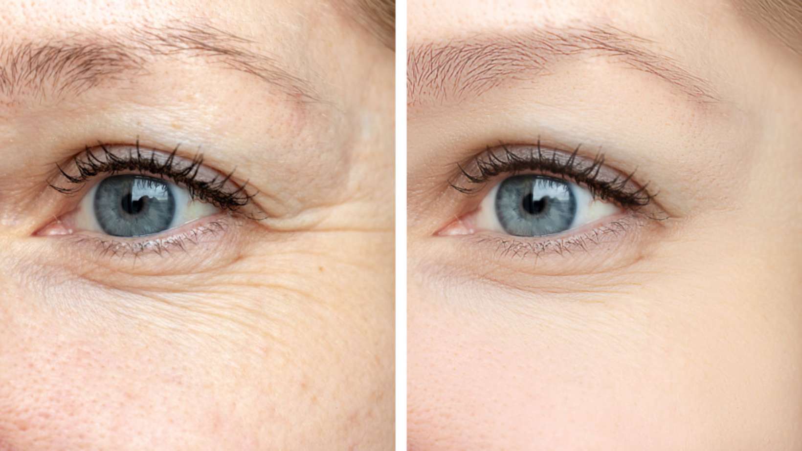 doc-berger-effect-creme-gegen-augenringe-vorher-nachher