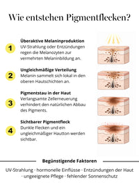 Infografik zur Entstehung von Pigmentflecken und Hyperpigmentierung der Haut – erklärt im Zusammenhang mit dem DOC BERGER EFFECT Purifying Power Serum gegen Pigmentflecken.