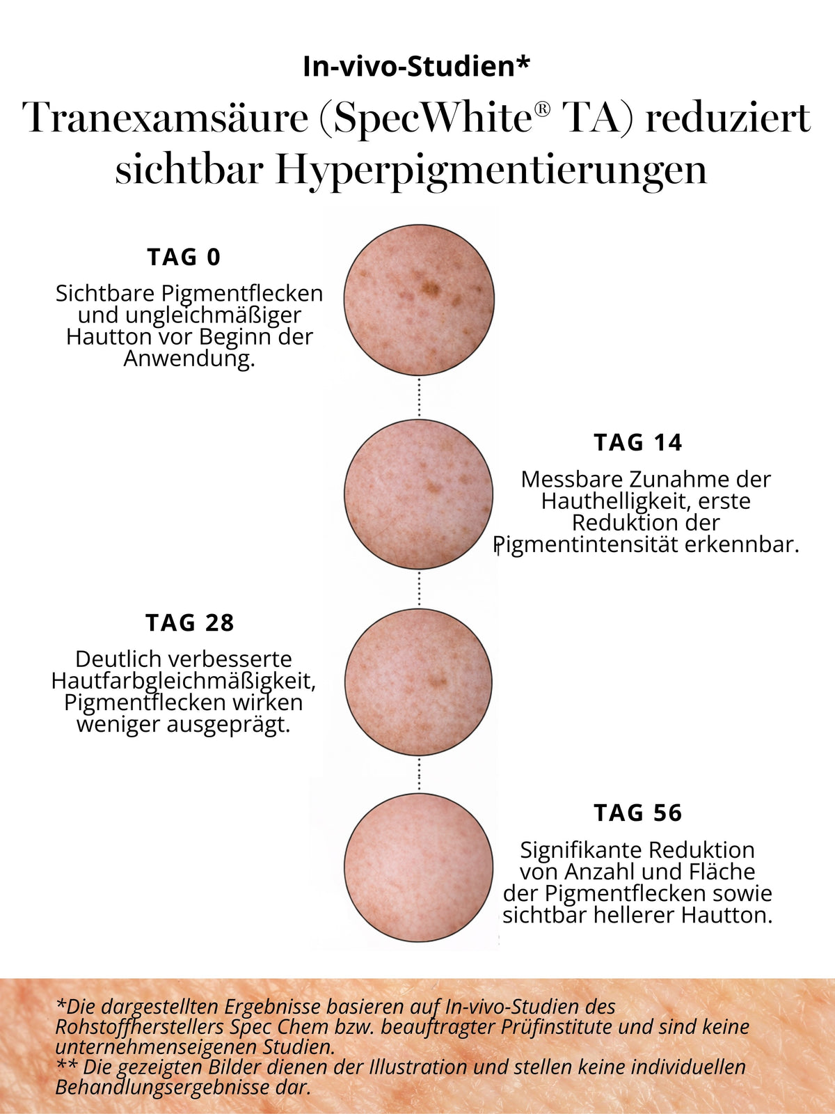 Studiengrafik zur Wirkung von Tranexamsäure im DOC BERGER EFFECT Purifying Power Serum gegen Hyperpigmentierung und dunkle Pigmentflecken.
