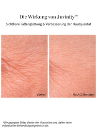 Studiengrafik zum Wirkstoff Juvinity™ in der DOC BERGER EFFECT Ultra Rich Night Cream – sichtbare Reduktion von Falten und Verbesserung der Hautqualität nach regelmäßiger Anwendung.