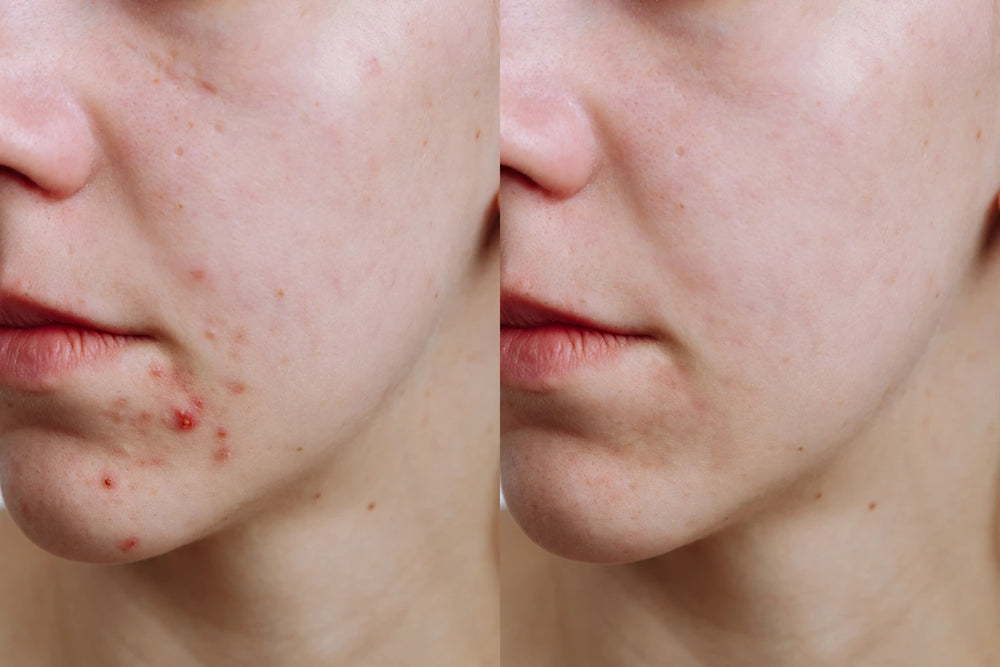 mischhaut kunde von doc berger effect nach der verwendung von Vit C Serum und der Daycream mit Lichtschutzfaktor